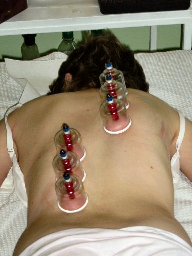 magnetick� ba�ky