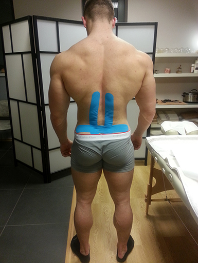 Tejpov�n� - kineziotejping