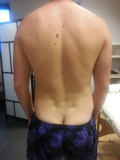 Funk�n� skoli�za