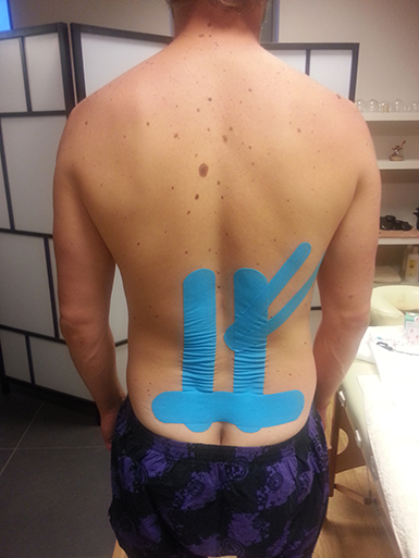 Tejpov�n� po terapii