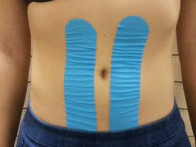 Tejpov�n� p��n�ho b�i�n�ho svalstva-relaxace